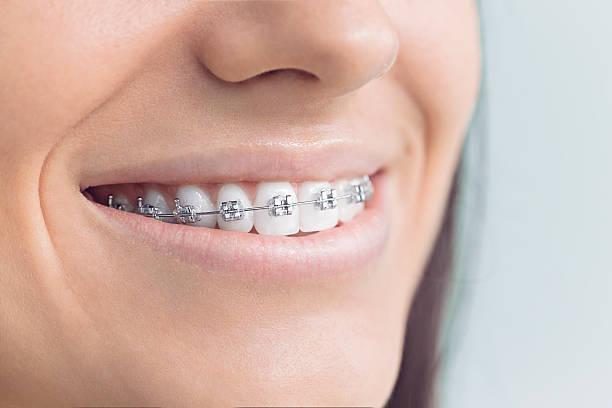 Best General Dentistry  in Issaquah, WA